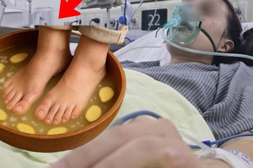 Ngâm chân bằng nước gừng nóng, người phụ nữ suýt phải cắt cụt chân