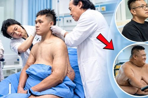 Từ 264kg còn 95kg, chàng trai xác lập kỷ lục Việt Nam khi cắt 17kg da thừa