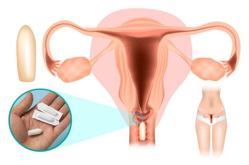 Vùng kín ngứa ngáy, đừng vội đặt thuốc nếu chưa biết điều này