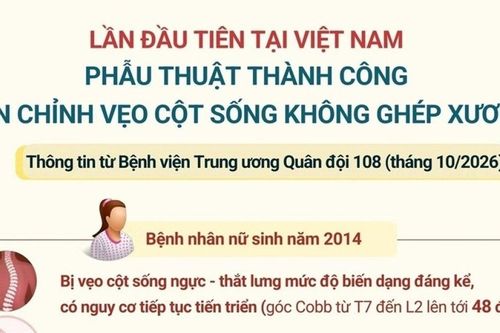 Kỹ thuật mới giúp bệnh nhân vẹo cột sống bảo tồn vận động