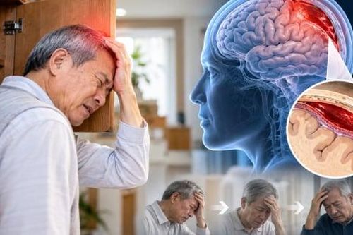 Va đập đầu tưởng nhẹ, nhiều tuần sau mới phát hiện tụ máu não