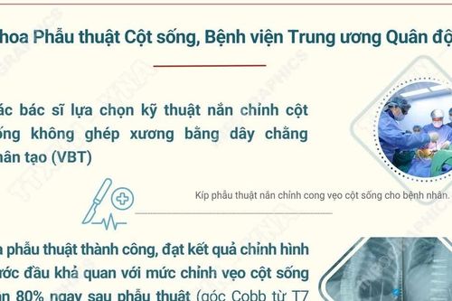 Việt Nam lần đầu phẫu thuật thành công nắn chỉnh vẹo cột sống không ghép xương
