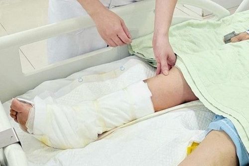 Người phụ nữ 65 tuổi nguy cơ mất chân sau khi đắp loại lá quen thuộc