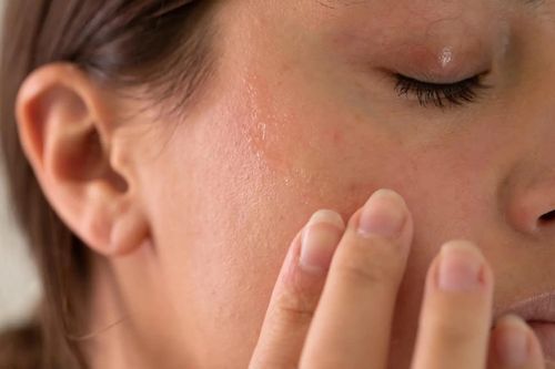 5 bí quyết cải thiện da bong tróc, phục hồi mịn màng mùa thu đông