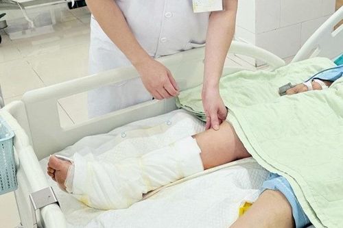 Đau nhói khi xỏ dép đi chợ, người phụ nữ đắp lá ớt rồi nhập viện vì chân hoại tử