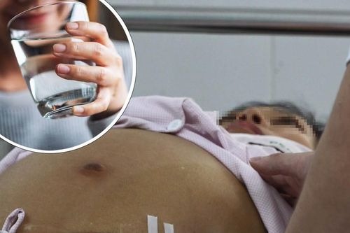 Uống 6 lít nước mỗi ngày làm đẹp da, người phụ nữ co giật rồi hôn mê