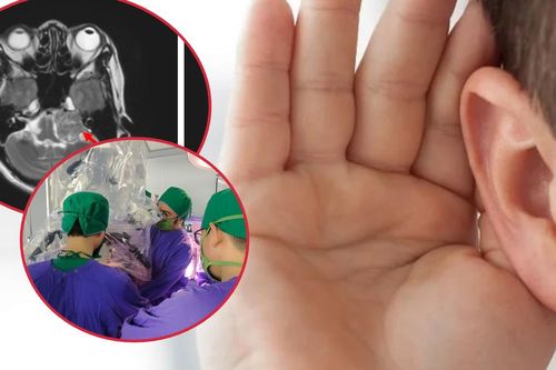 Đau đầu phát hiện khối u nằm ở vị trí nguy hiểm trong não
