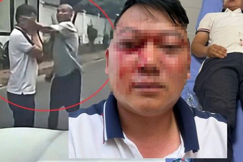 Vợ tài xế bị đánh gục giữa đường ở Phú Thọ tiết lộ thương tích của chồng