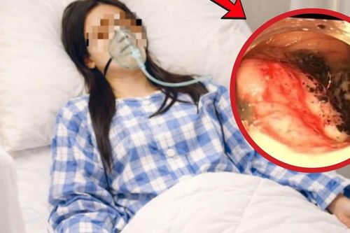 Nữ vận động viên 23 tuổi phát hiện ung thư đại tràng từ dấu hiệu đau bụng