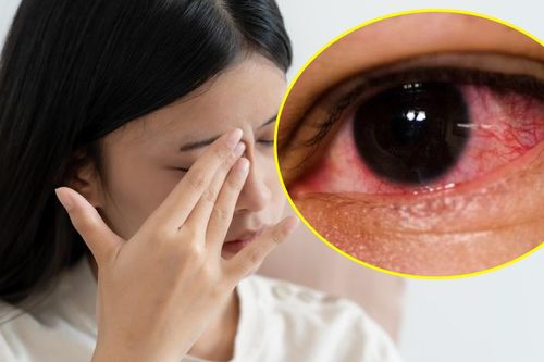 Mắt trái sưng đỏ kèm đau đầu, bác sĩ phát hiện nguyên nhân ít ai ngờ