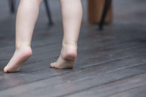 Bé trai đi nhón chân suốt nhiều tháng, phát hiện dị dạng mạch máu tủy sống