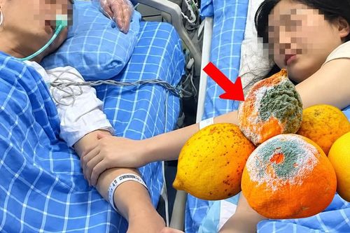 Hai vợ chồng chưa đầy 30 tuổi cùng mắc ung thư vì thói quen tiếc đồ ăn