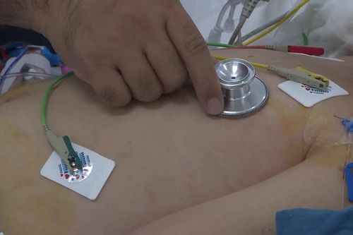 Chủ động phòng bệnh não mô cầu