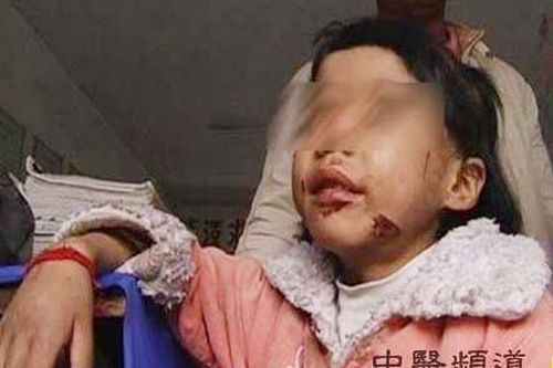 Phẫn nộ chuyện bố bôi phân lên miệng con gái