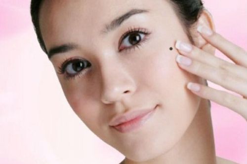 Mặt nhiều nốt ruồi, phúc hay họa?