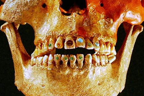 Top sự thật không tưởng về hàm răng