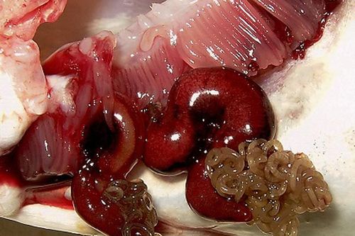 Ký sinh trùng và những lợi ích không ngờ