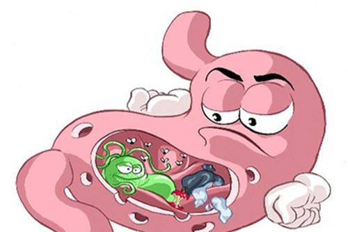 Những yếu tố hàng đầu gây bệnh viêm dạ dày