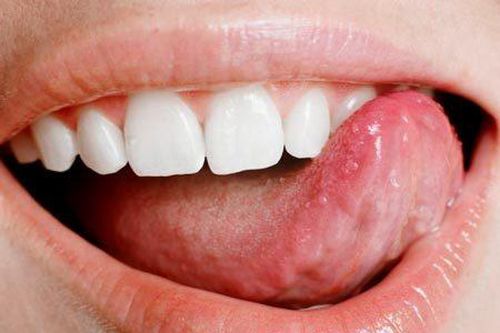 Lưỡi người có giác quan thứ 6?