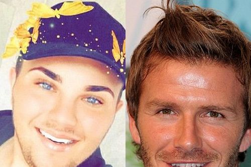 9X nỗ lực phẫu thuật giống Beckham để nổi tiếng