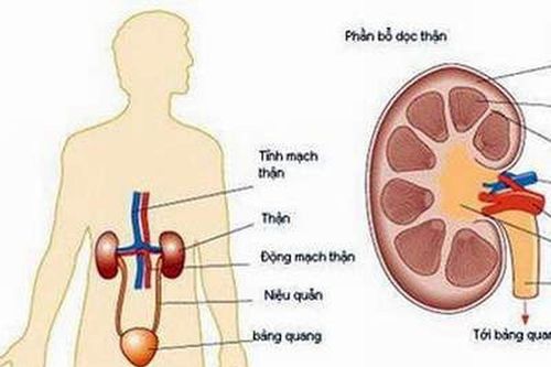Dấu hiệu bị viêm cầu thận