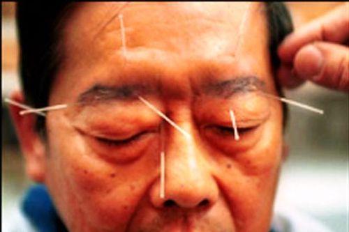 Mùa lạnh: Cảnh giác méo miệng, liệt mặt