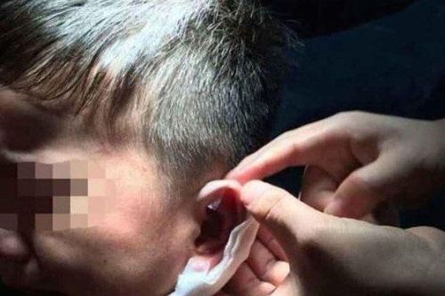 Những vụ bạo hành trẻ chấn động thế giới: Dập ghim vào tai, đâm trọng thương trẻ nhỏ