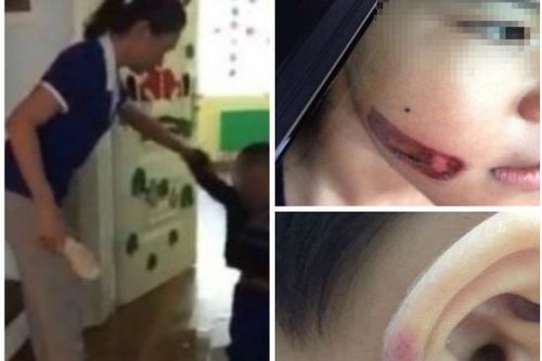 Những vụ bạo hành trẻ em khiến dư luận phẫn nộ thời gian qua