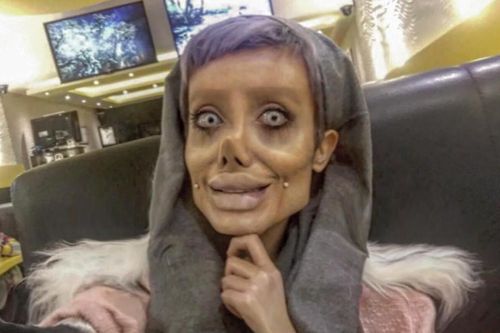 'Cô gái xác sống' giống Angelina Jolie là sản phẩm photoshop?