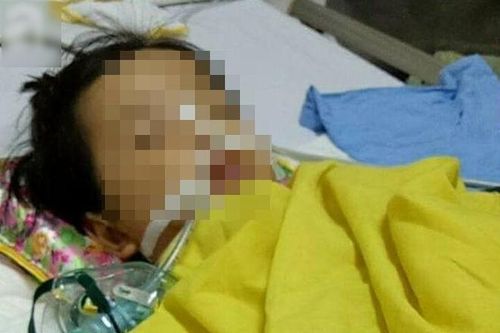 Bé gái 20 tháng tuổi bị rạn hộp sọ sau 3 ngày đến trường