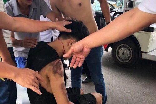 Xe điện tông du khách ở Đà Nẵng, 6 người bị thương