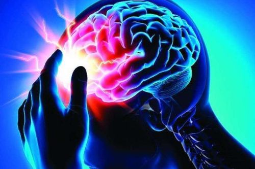 Điều gì xảy ra khi bạn bị đột quỵ?