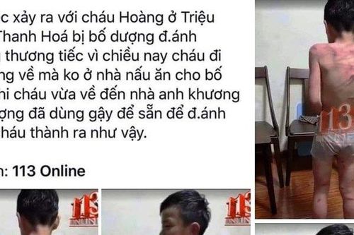 Xác minh thông tin bé trai bị bố dượng đánh đập dã man ở Thanh Hóa