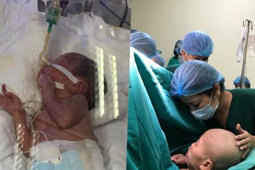 Mẹ ung thư nhường sự sống cho con: Hình ảnh mới nhất của bé Bình An