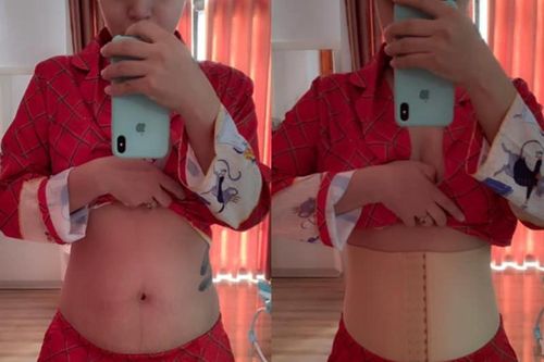 Bí kíp lấy lại eo thon sau sinh của Hải Băng khiến bác sĩ kinh hãi