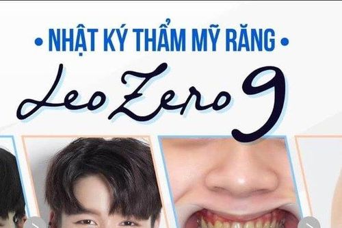 Hàm răng xấu đang hủy hoại tương lai của bạn như thế nào?