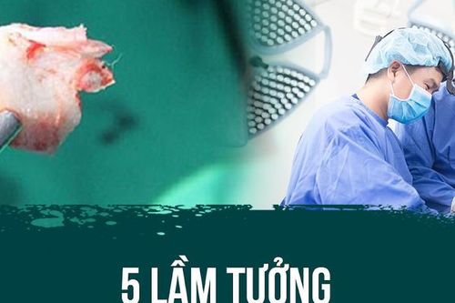 5 lầm tưởng về nâng mũi bọc sụn ai cũng gặp phải