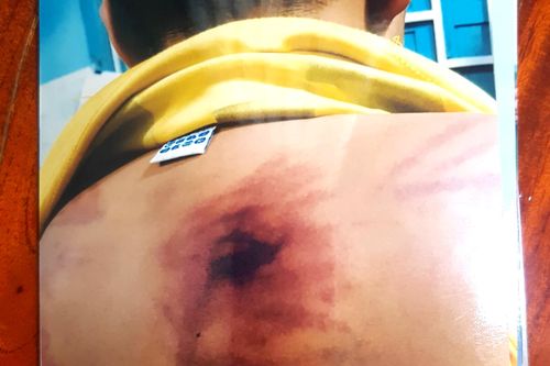 Cư sĩ nhận sai khi đánh bé trai 11 tuổi ngay trong chùa