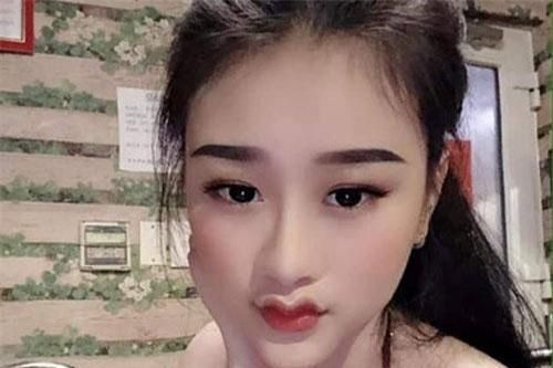Hot trend môi cánh én biến dạng, chị em nghiện 'dao kéo' rần rần chạy theo