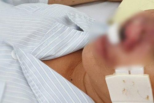 Sự thật sau tin đồn Quảng Bình xuất hiện 'vi khuẩn ăn thịt người'