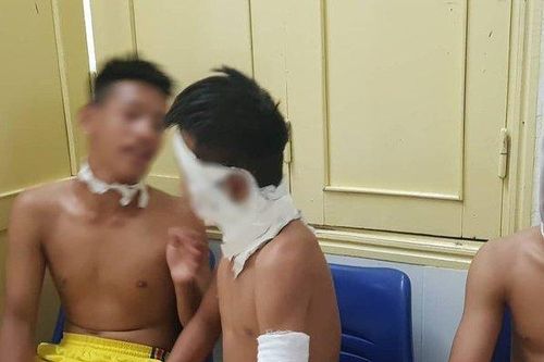 3 cầu thủ bóng đá nhập viện do chùm bóng bay phát nổ