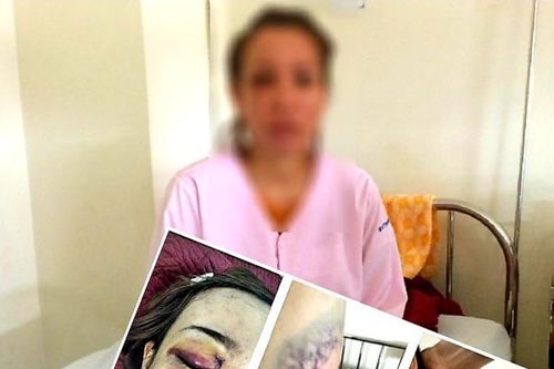 Quảng Trị: Một phụ nữ mang thai bị gã hàng xóm hành hung nhập viện