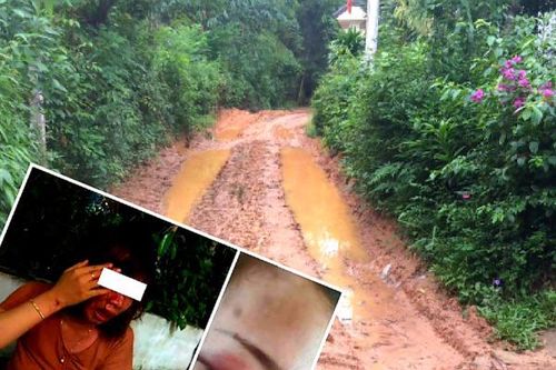 Lý do bất ngờ khiến gã hàng xóm đánh người phụ nữ đang mang thai nhập viện