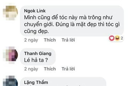 Bị chê mắt lác, Mi Vân: 'Cả hai mắt phải thay thủy tinh thể, mắt trái gần như mù'
