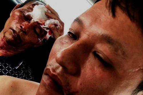 Thanh Hóa: Côn đồ vào tận nhà truy sát, 3 người bị thương