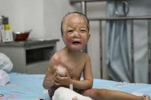 Những điều mẹ cần biết để không làm trẻ bị bỏng khi tắm