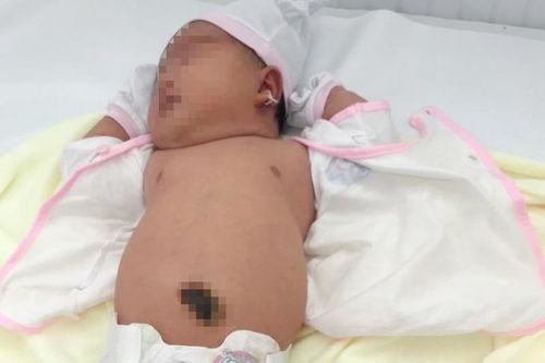 TP.HCM: Bệnh viện Quận 11 đón bé gái chào đời nặng 5,2kg