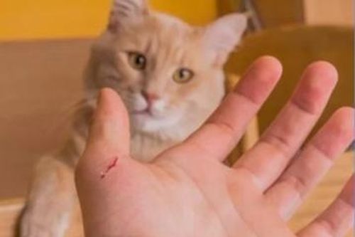 Bị mèo cào, người phụ nữ sốc nhiễm trùng, suy đa tạng suýt chết
