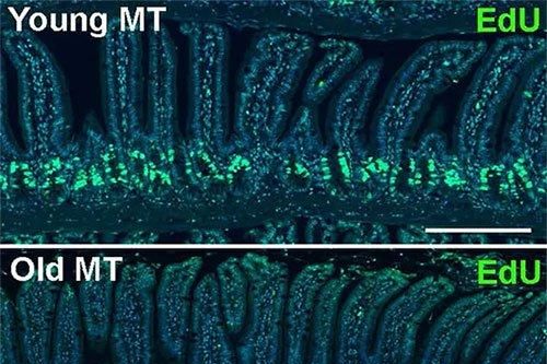Vi khuẩn trong ruột có thể làm thay đổi quá trình lão hóa
