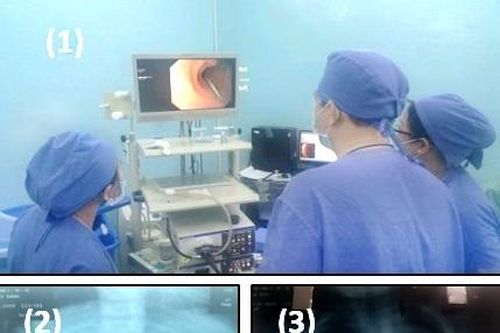 Bệnh viện cùng lúc cấp cứu 2 bệnh nhi nuốt đinh suýt thủng ruột non